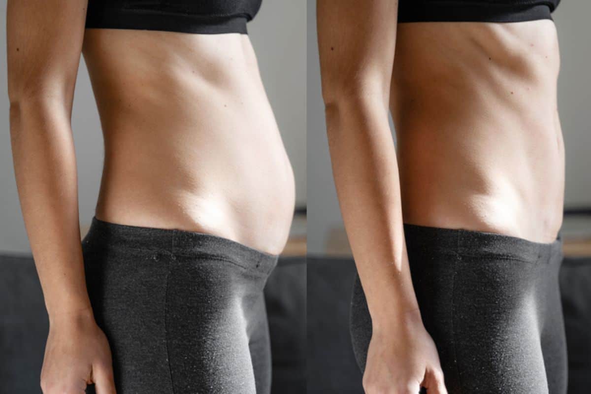 Post-Pregnancy: What Happens to Your Abdominal Muscles After Birth Wisbech
