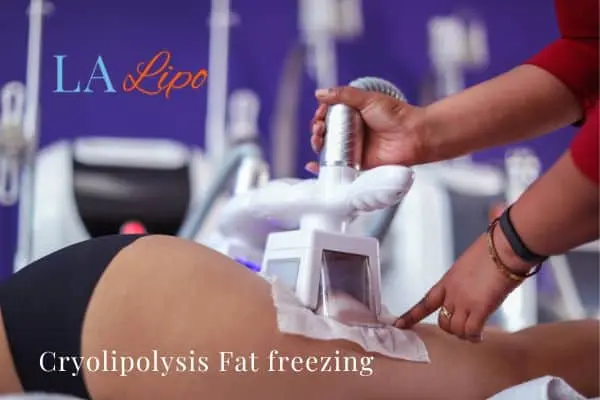 women getting fat freezing Wisbech