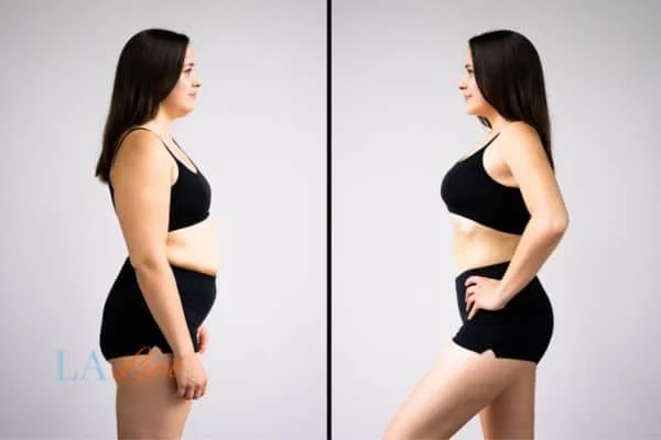 link between body image and mental health Wisbech