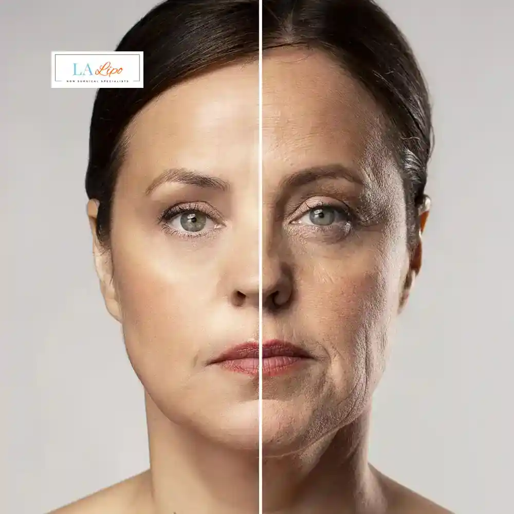 How Can You Tell If Non-Surgical Skin Tightening Is Right for You Wisbech?