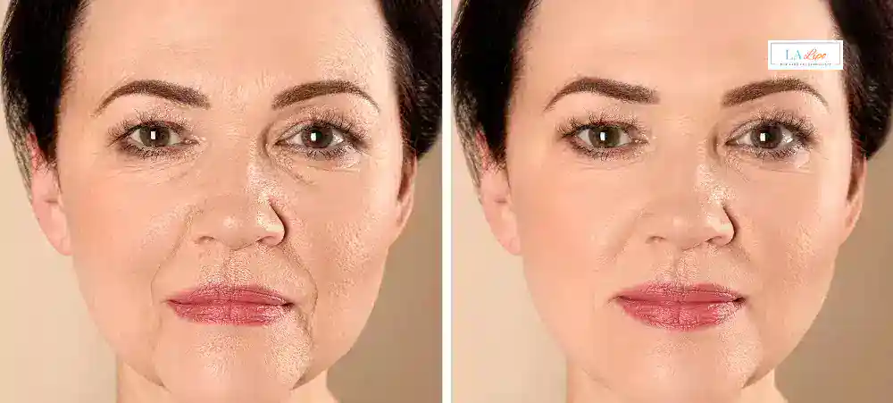 Why Aren’t My Skincare Products Making My Sagging Skin Look Firmer Wisbech?