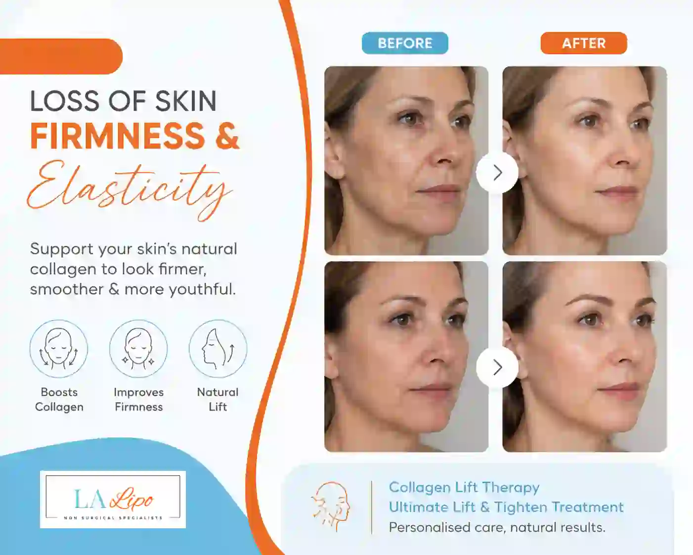 Sign #7: Loss of Skin Firmness and Elasticity Wisbech